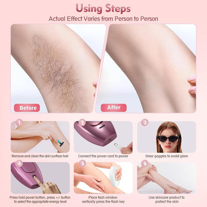 Mini Laser Hair Removal