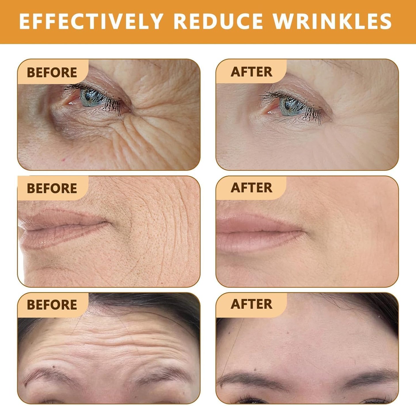 Botox Effect Bee Venom Cream