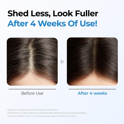 Scalpy Growth Serum - Hair Fall Solution