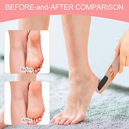 Electric Pedicure Foot File Callus Remover