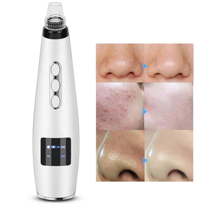 Electric Black Head Suction Instrument Face Cleaner